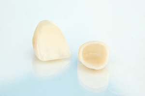 Two dental crowns resting on light, reflective surface
