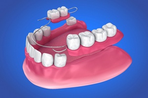 3D illustration of partial dentures in Newington against blue background