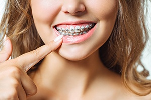 Woman with manicured fingers pointing at her braces in Newington