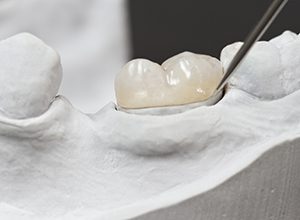 Model tooth with dental crown