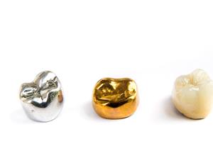 silver, gold, and ceramic crowns