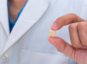 Dentist holding extracted tooth between thumb and forefinger