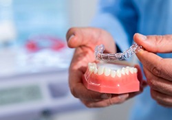 Dentist holding Invisalign aligner over tooth model
