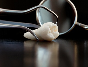 extracted tooth