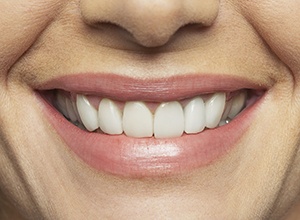 Closeup of natural looking dentures