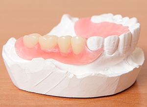 Model smile with partial denture