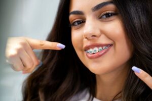 Smiling young woman pointing at her braces 
