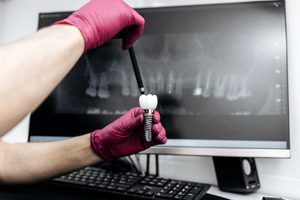 Gloved hands holding dental implant model 